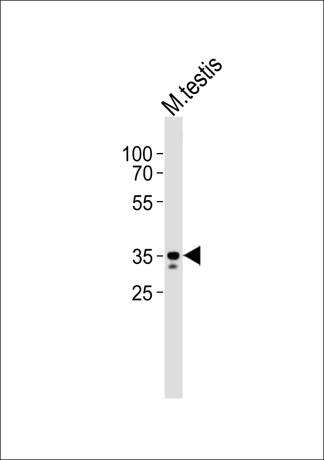 Rabbit Polyclonal Antibody to Mouse Ring1