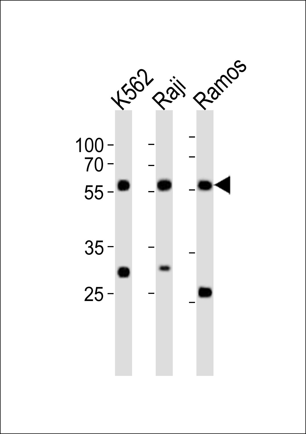 Rabbit Polyclonal Antibody to LYN