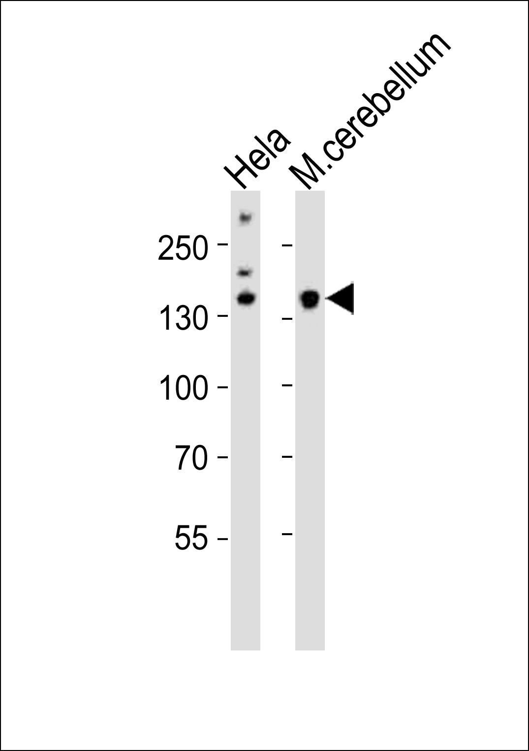 Rabbit Polyclonal Antibody to Mouse Kdm6b