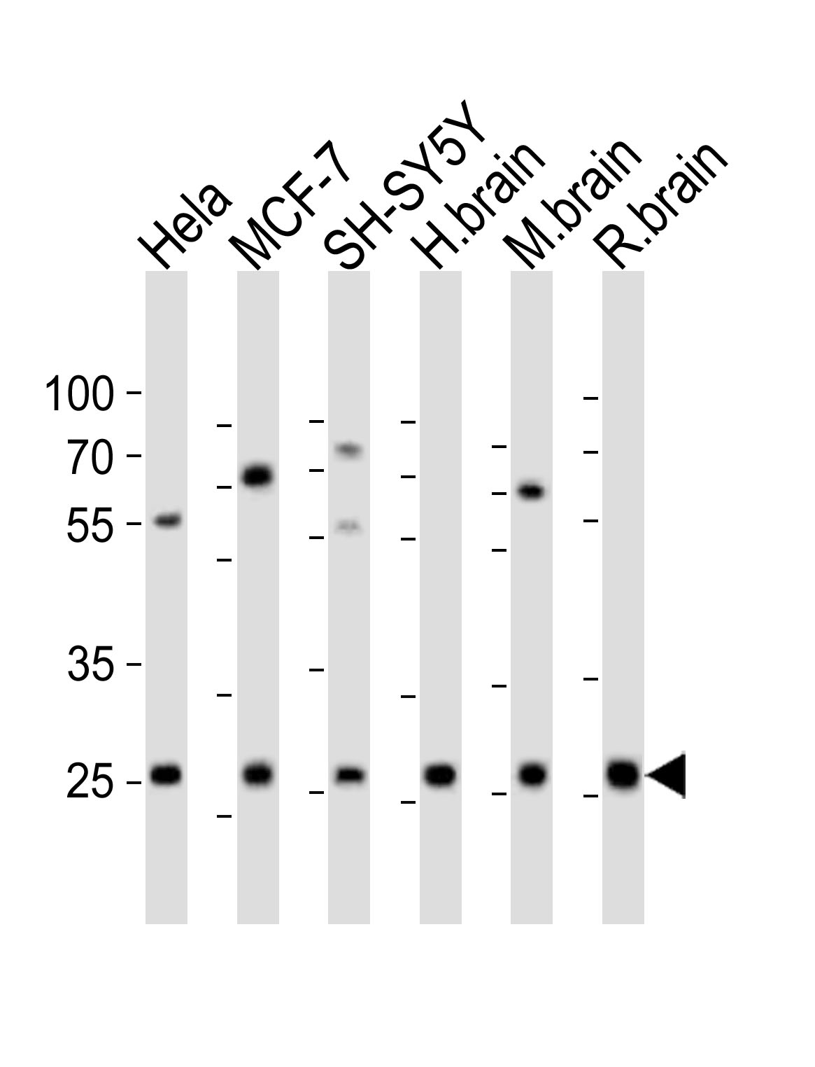 Rabbit Polyclonal Antibody to NTF3