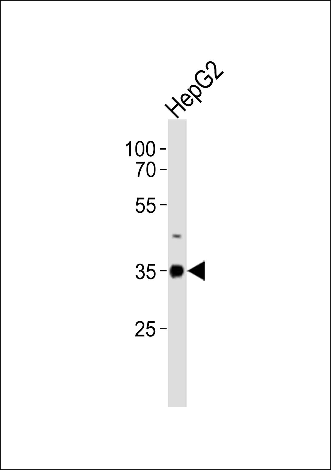 Rabbit Polyclonal Antibody to ABT1