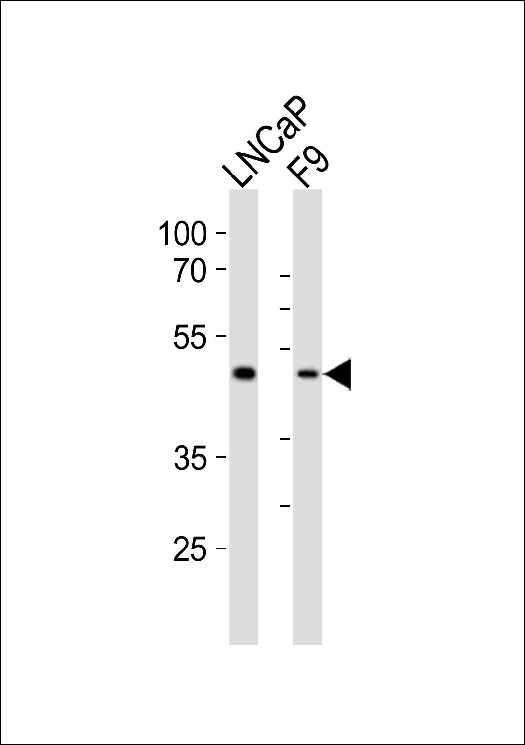 Rabbit Polyclonal Antibody to (Mouse) Sox17