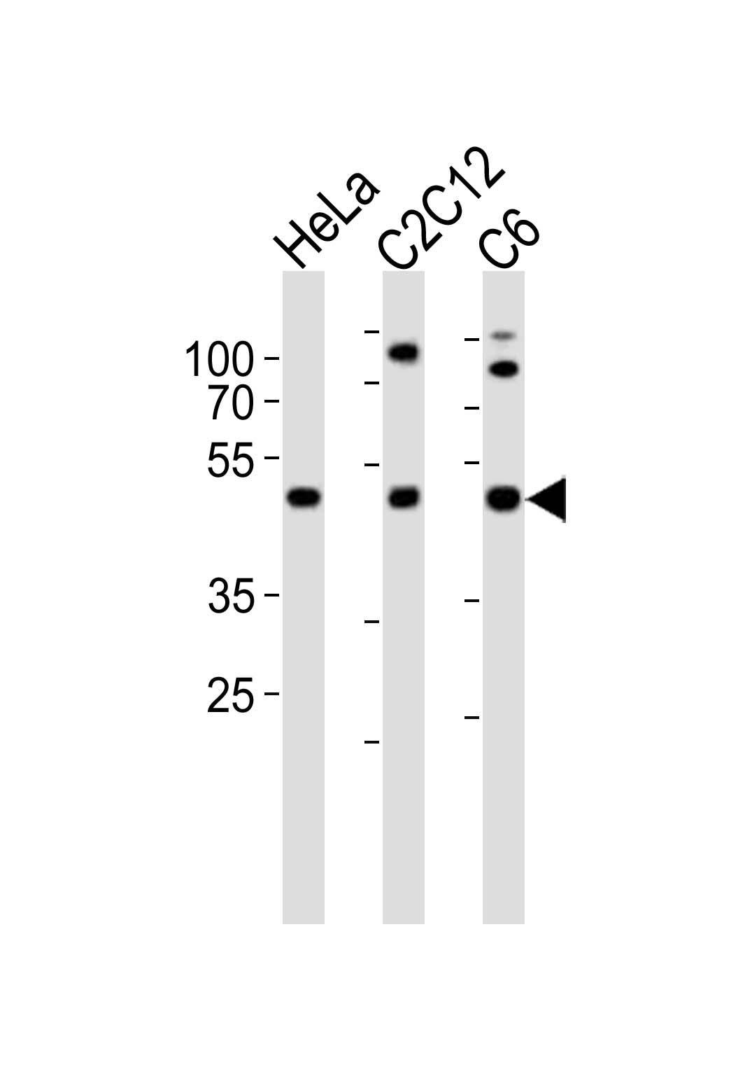 Rabbit Polyclonal Antibody to PAFAH1B1 (N-term)