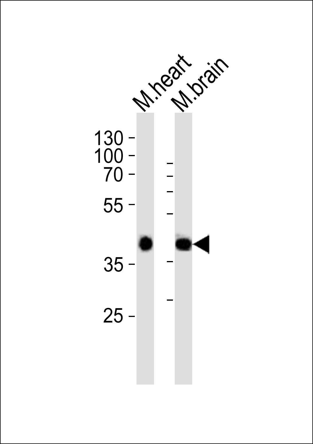 Rabbit Polyclonal Antibody to Mouse Sbk1 (N-term)