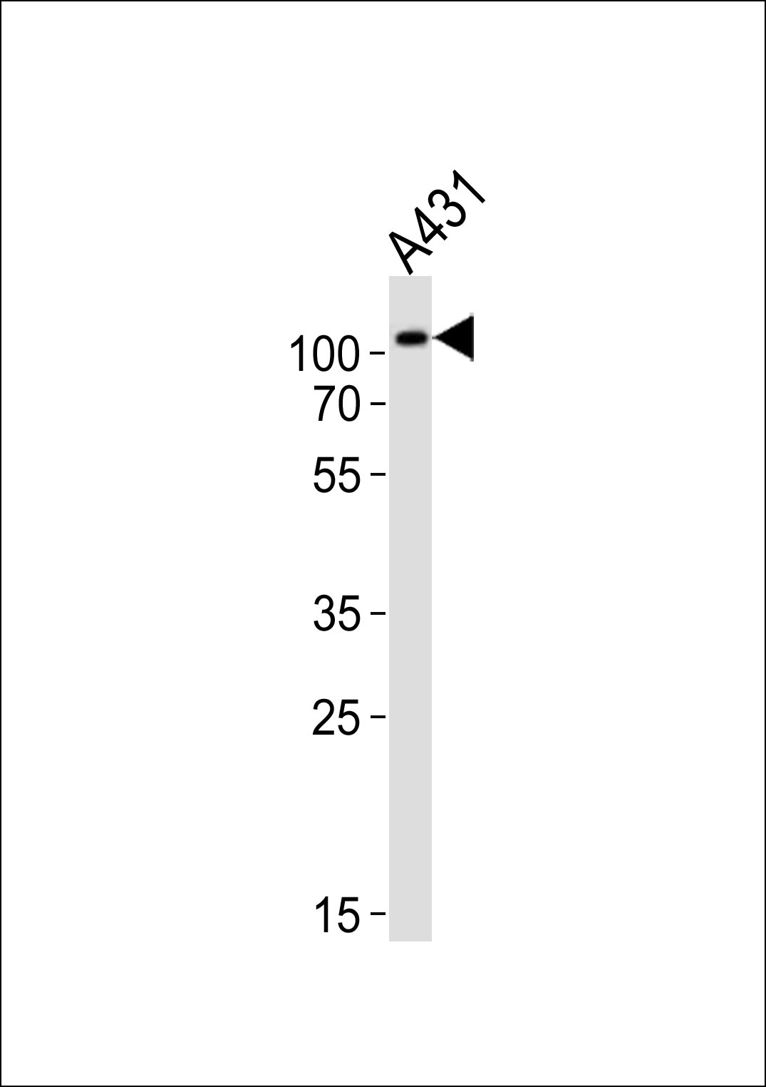 Rabbit Polyclonal Antibody to IARS2 (N-term)