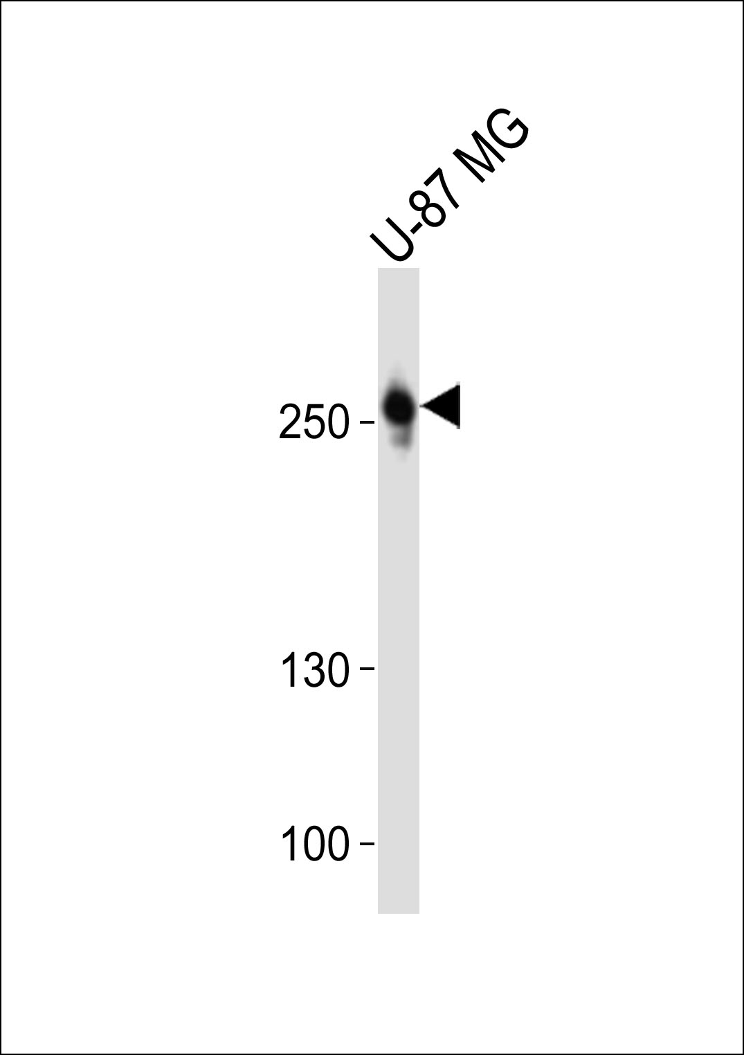 Rabbit Polyclonal Antibody to ROS1