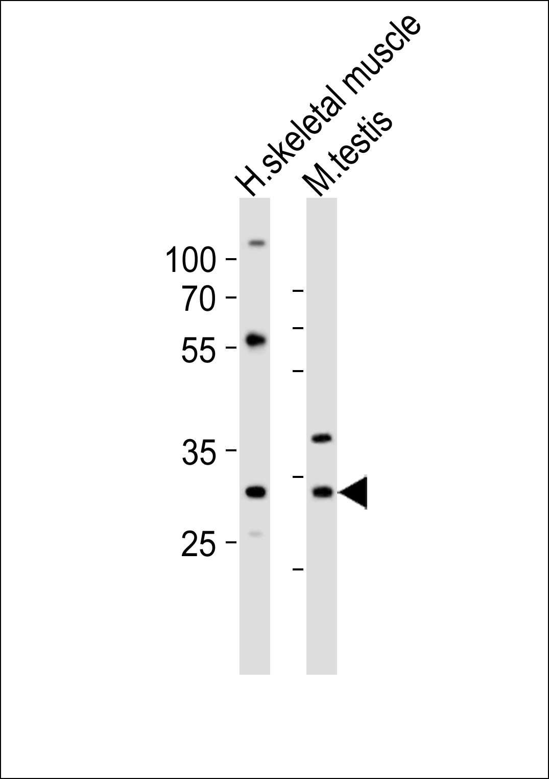 Rabbit Polyclonal Antibody to (Mouse) Mlf1