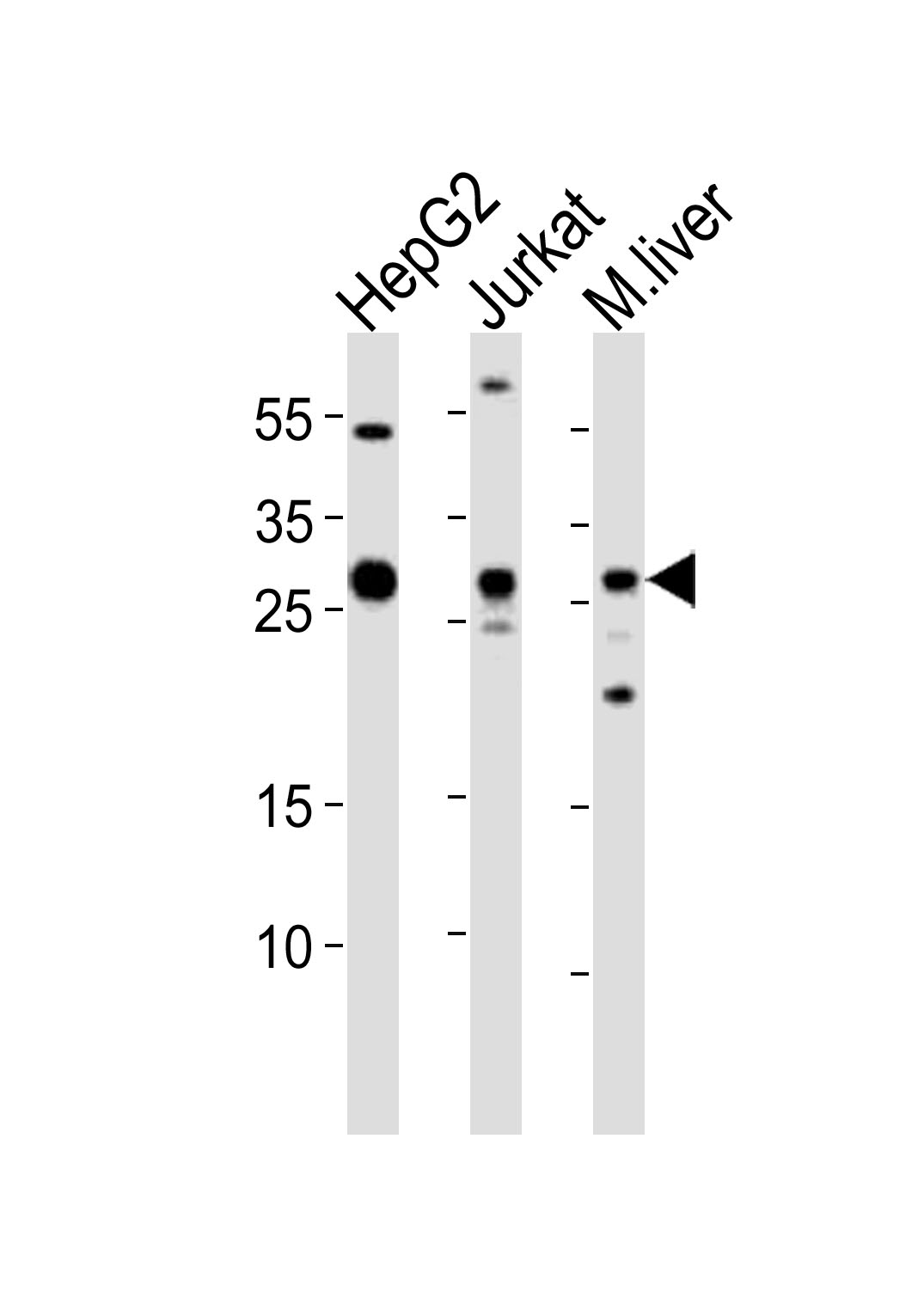 Rabbit Polyclonal Antibody to CTDSP1