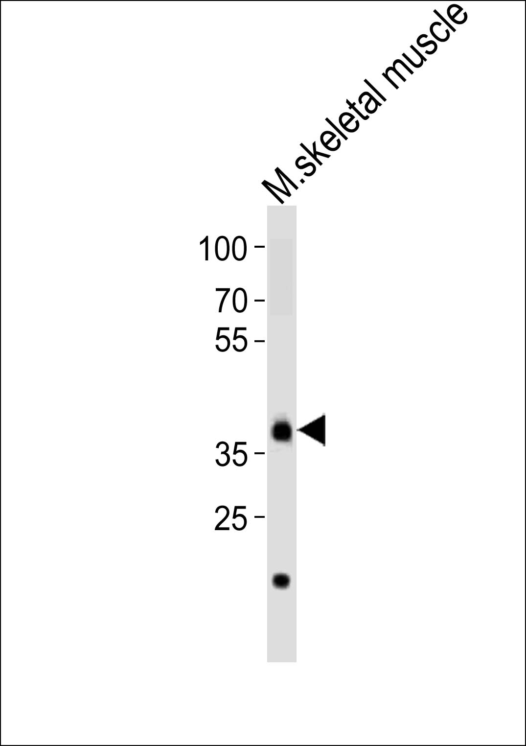 Rabbit Polyclonal Antibody to Mouse Dbx1