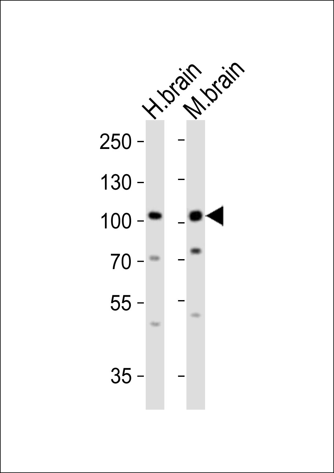 Rabbit Polyclonal Antibody to Mouse Epha6