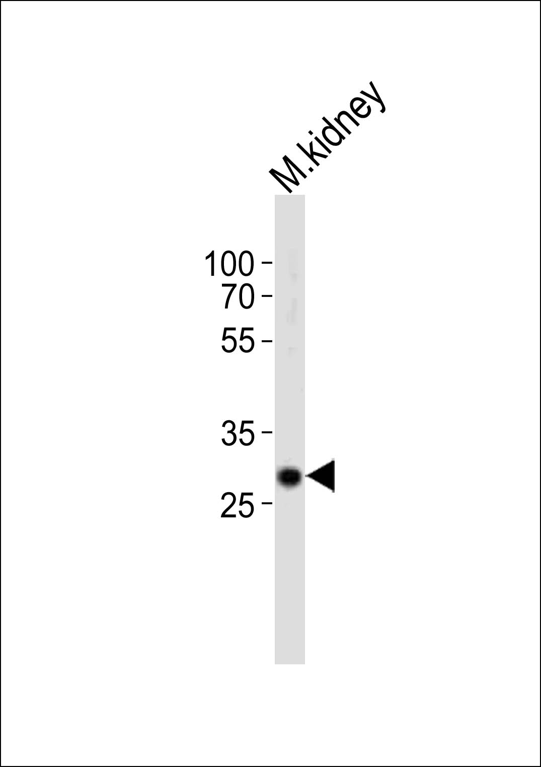 Rabbit Polyclonal Antibody to Mouse Hes1