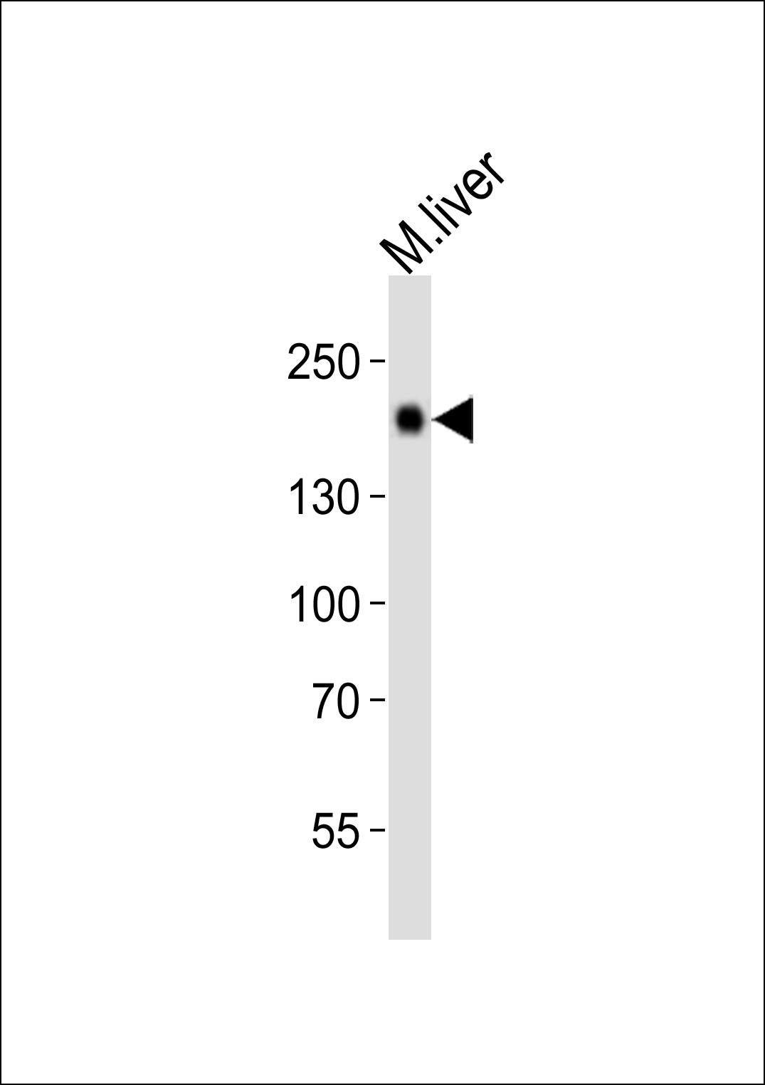 Rabbit Polyclonal Antibody to Mouse Egfr (P1116)
