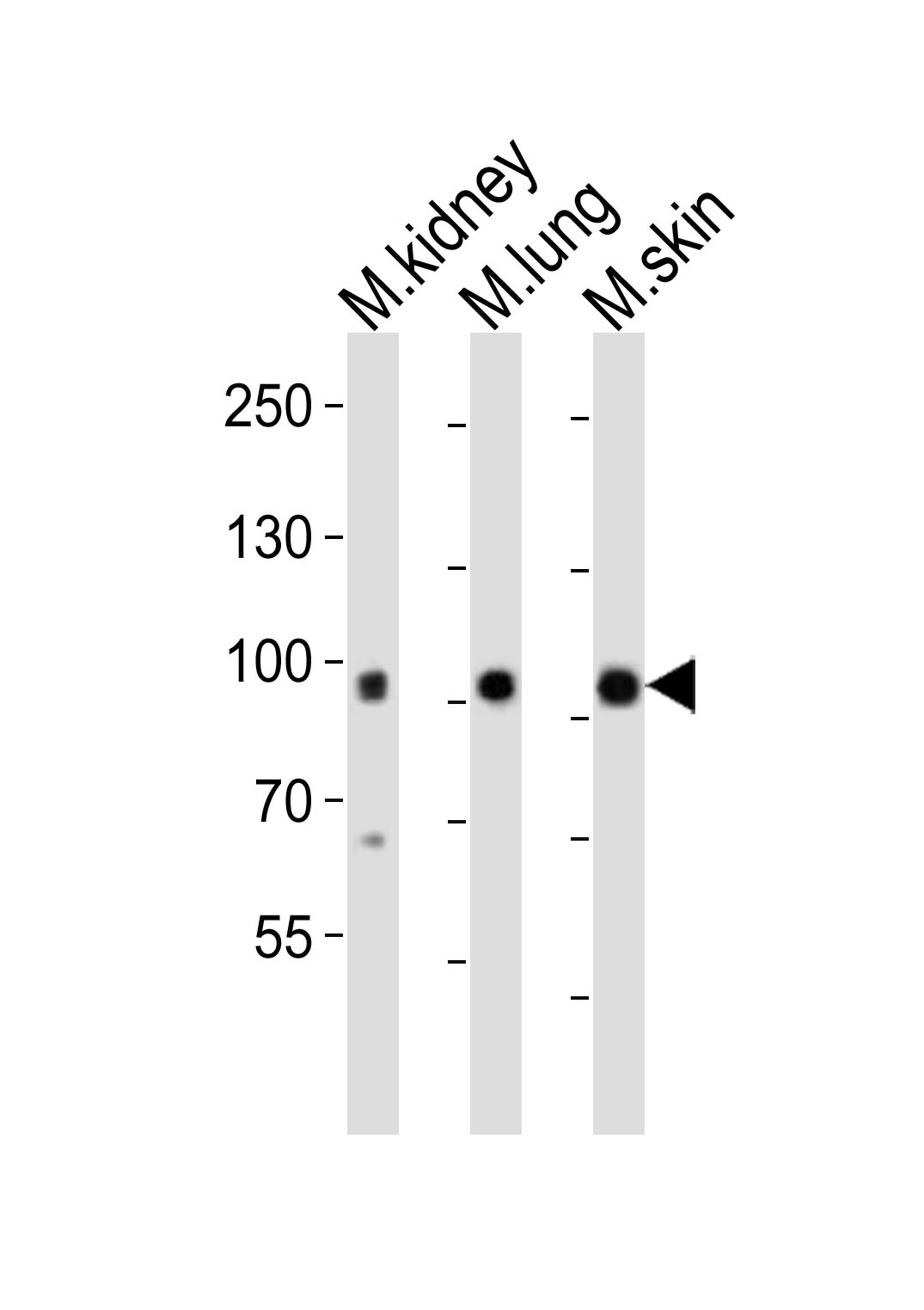 Rabbit Polyclonal Antibody to Mouse Epha1 (N-term)