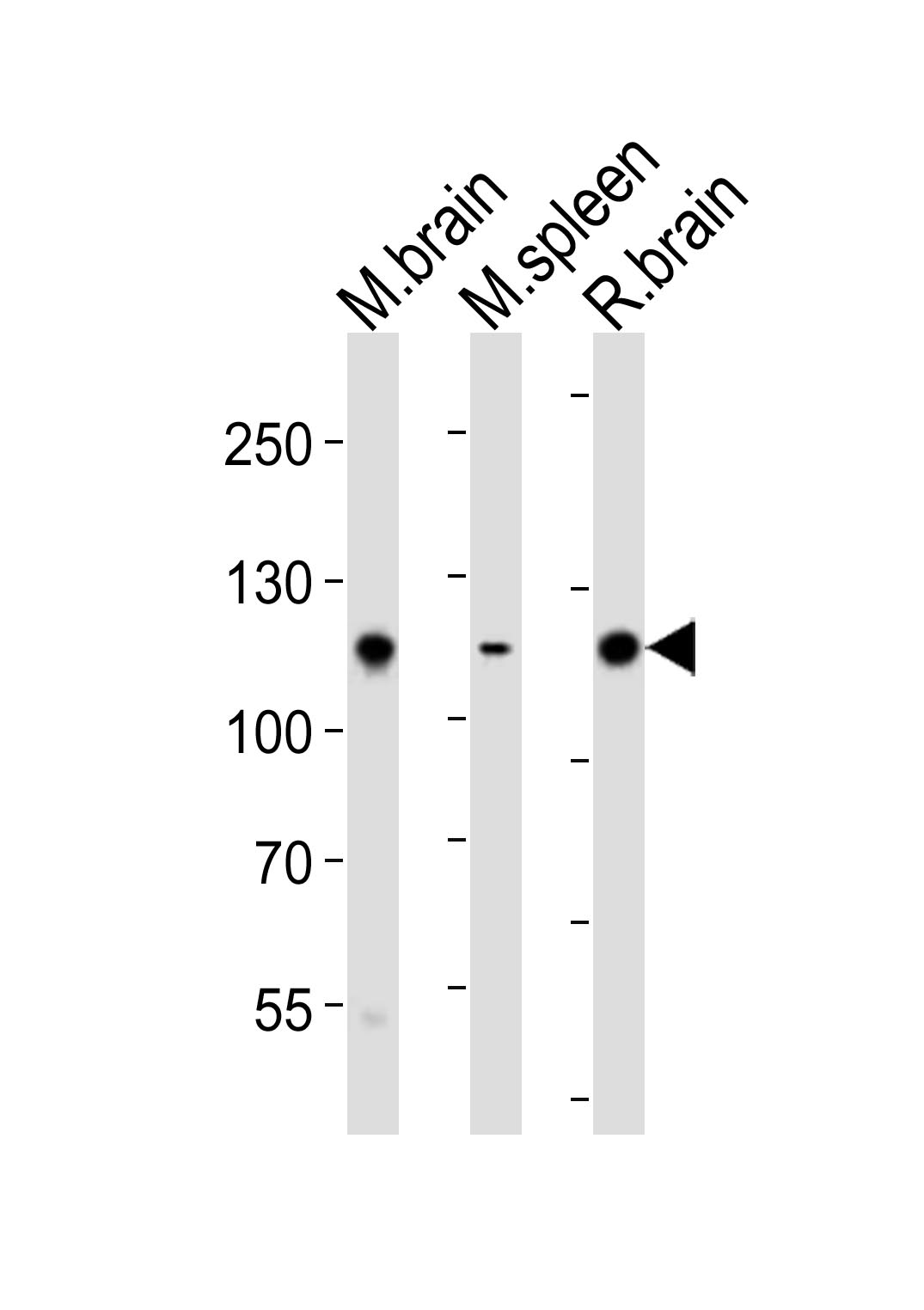 Rabbit Polyclonal Antibody to Mouse Ptk2b (P769)