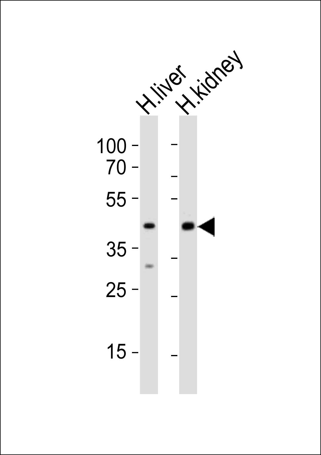 Rabbit Polyclonal Antibody to POU5F1B