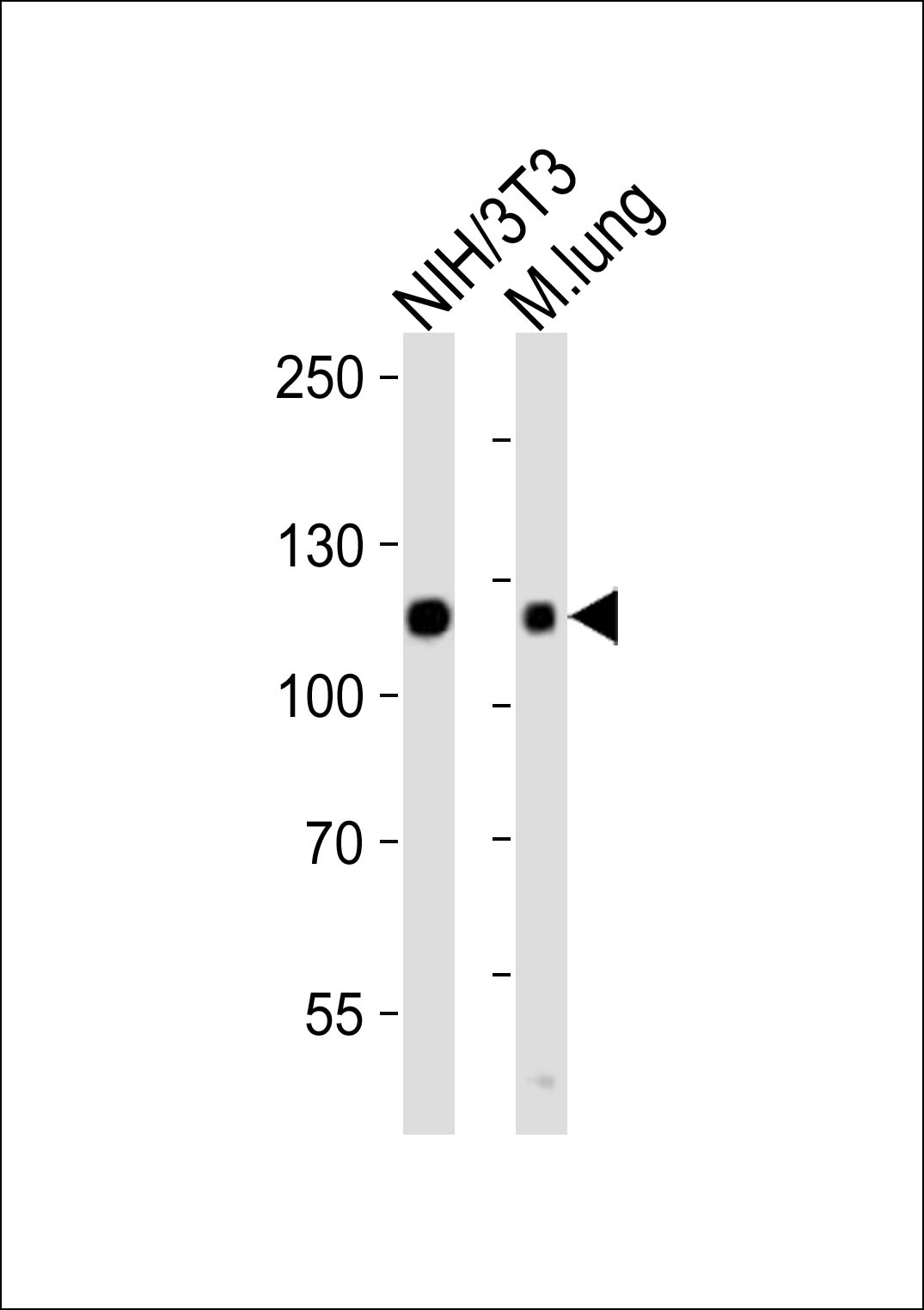 Rabbit Polyclonal Antibody to Mouse Ddr2