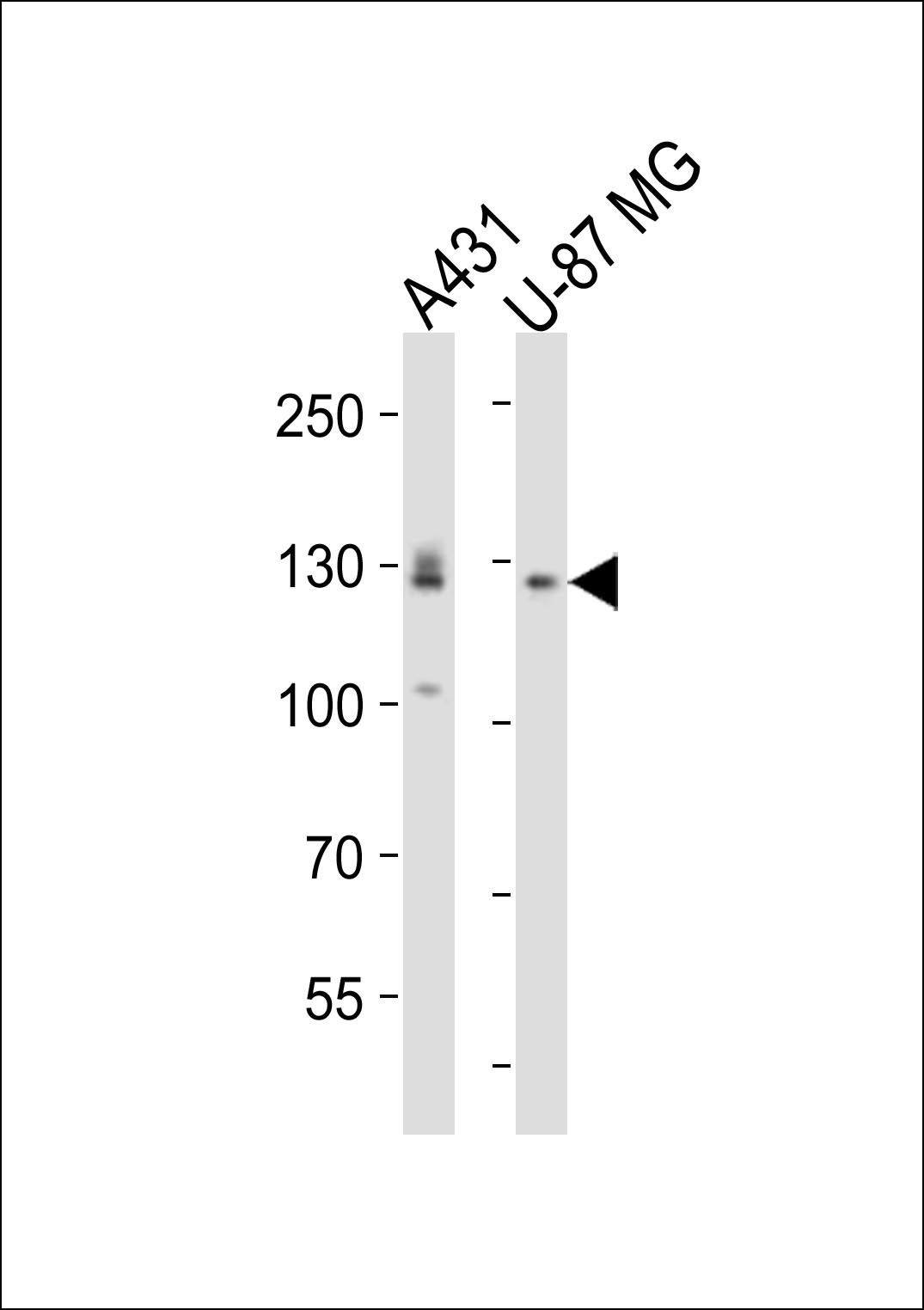 Rabbit Polyclonal Antibody to EPHA2