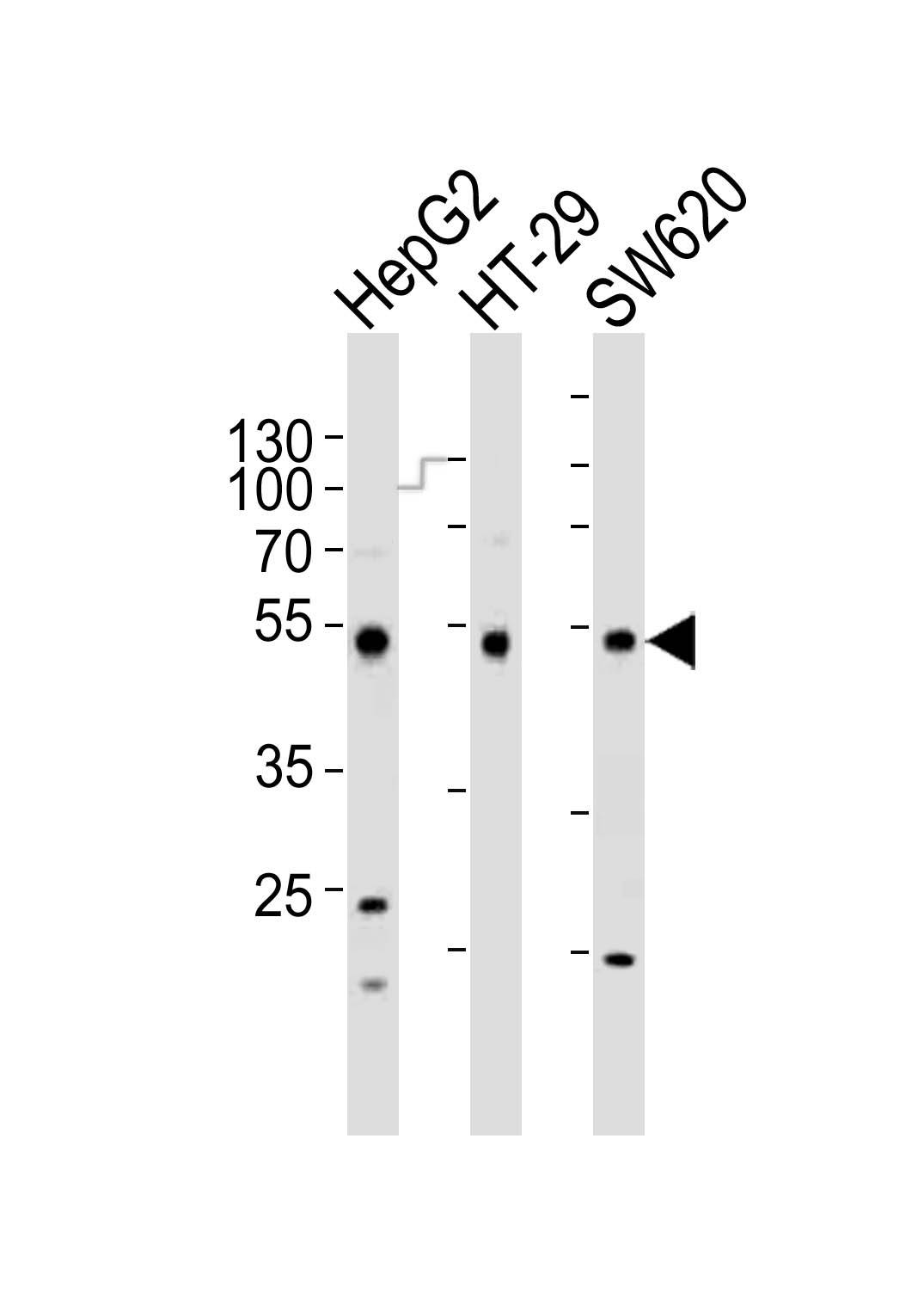 Rabbit Polyclonal Antibody to FOXA2