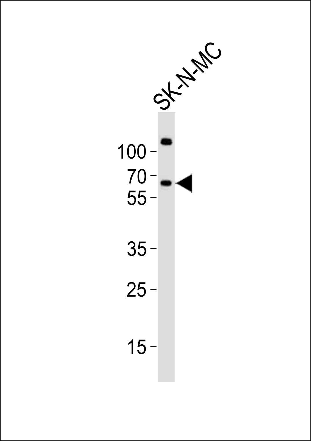 Rabbit Polyclonal Antibody to PPP2R5B