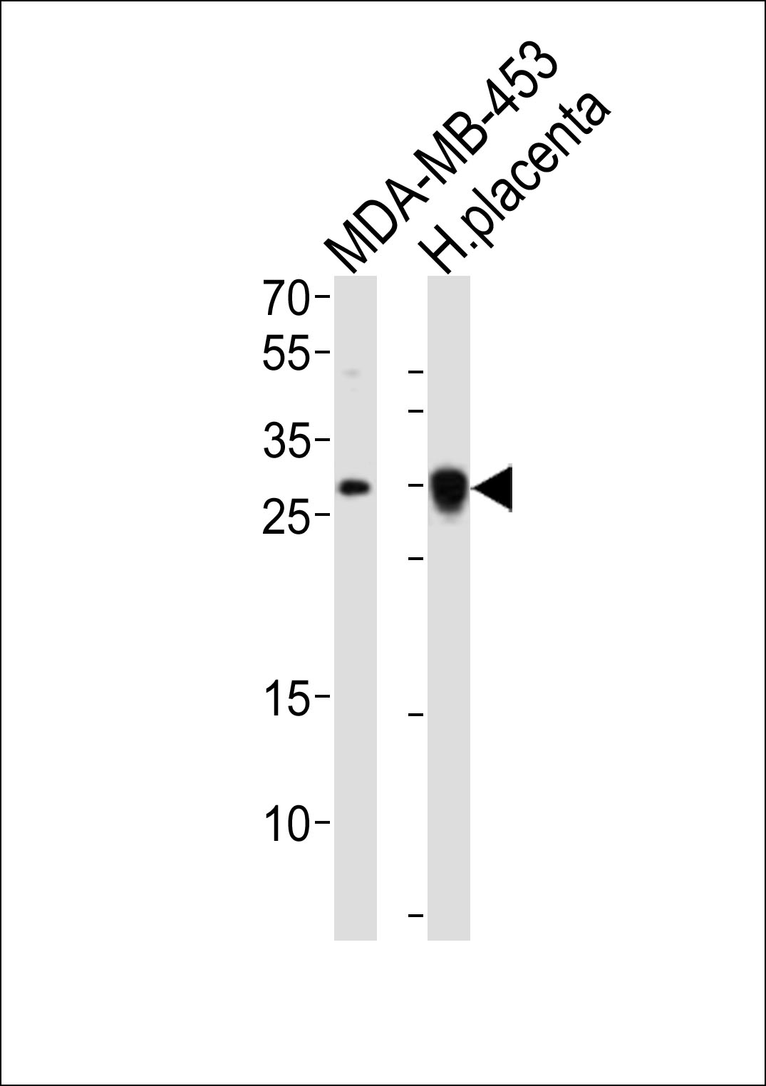 Rabbit Polyclonal Antibody to FOLR2 (N-term)