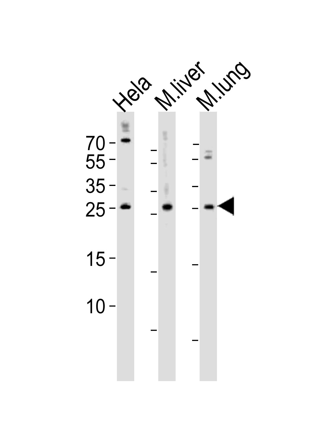 Rabbit Polyclonal Antibody to SOST (N-term)