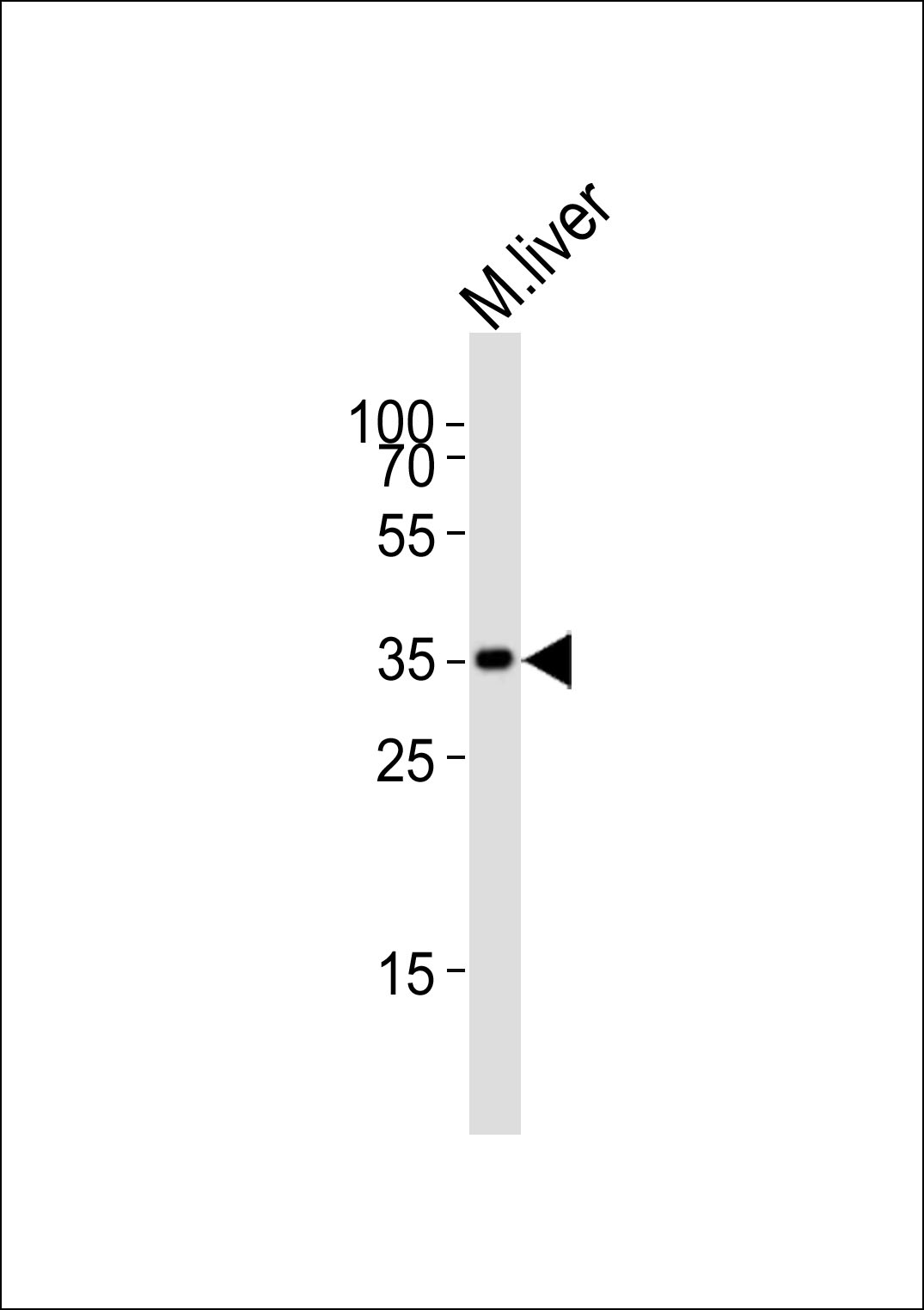 Rabbit Polyclonal Antibody to HMX2