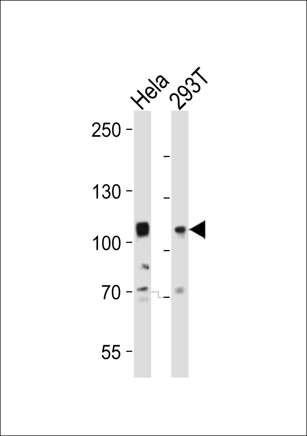 Rabbit Polyclonal Antibody to EPHA10 (N-term)