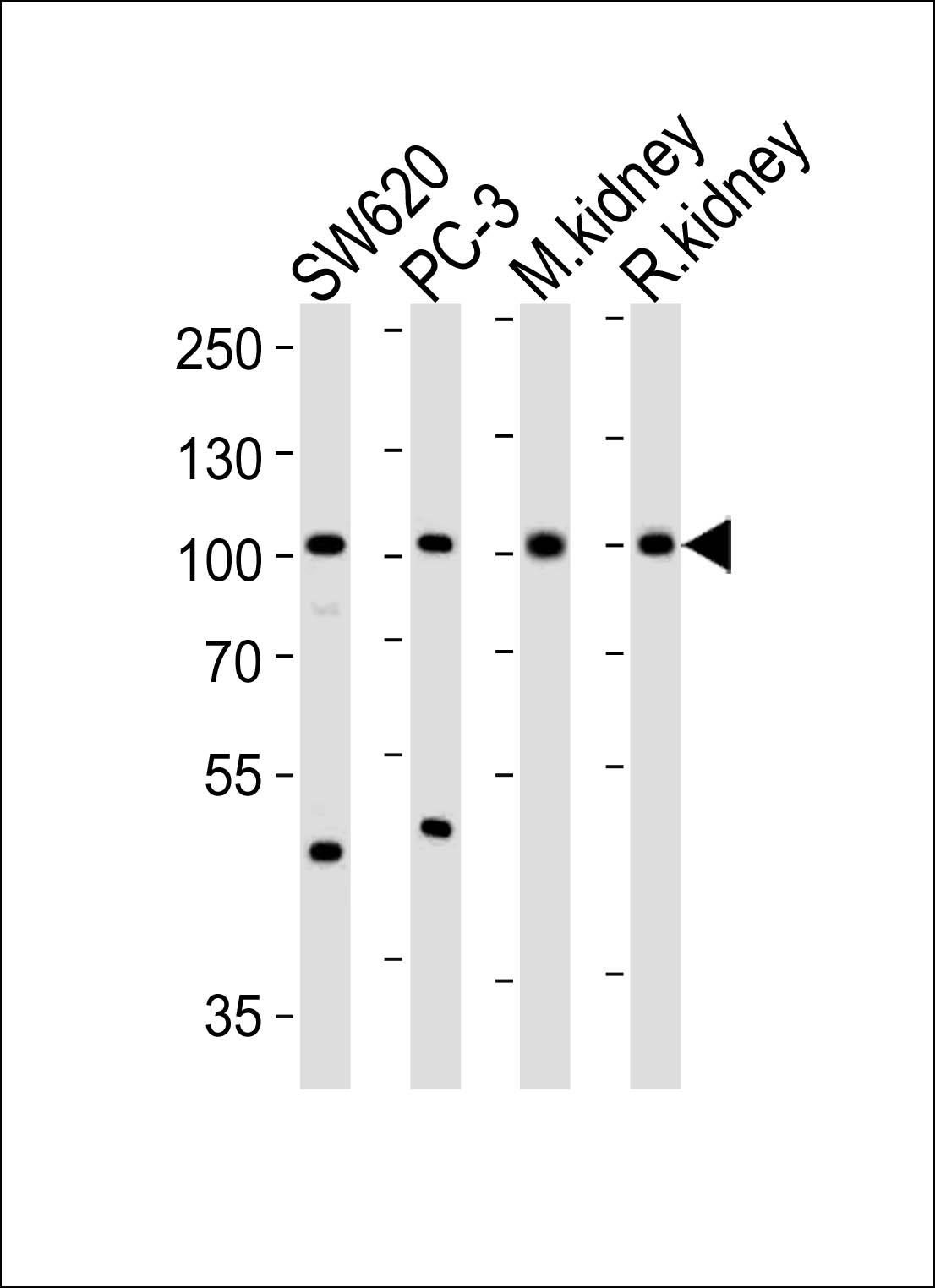 Rabbit Polyclonal Antibody to SUPV3L1 (N-term)