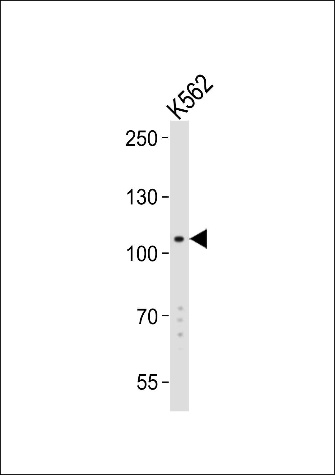 Mouse Monoclonal Antibody to LGR5/GPR49