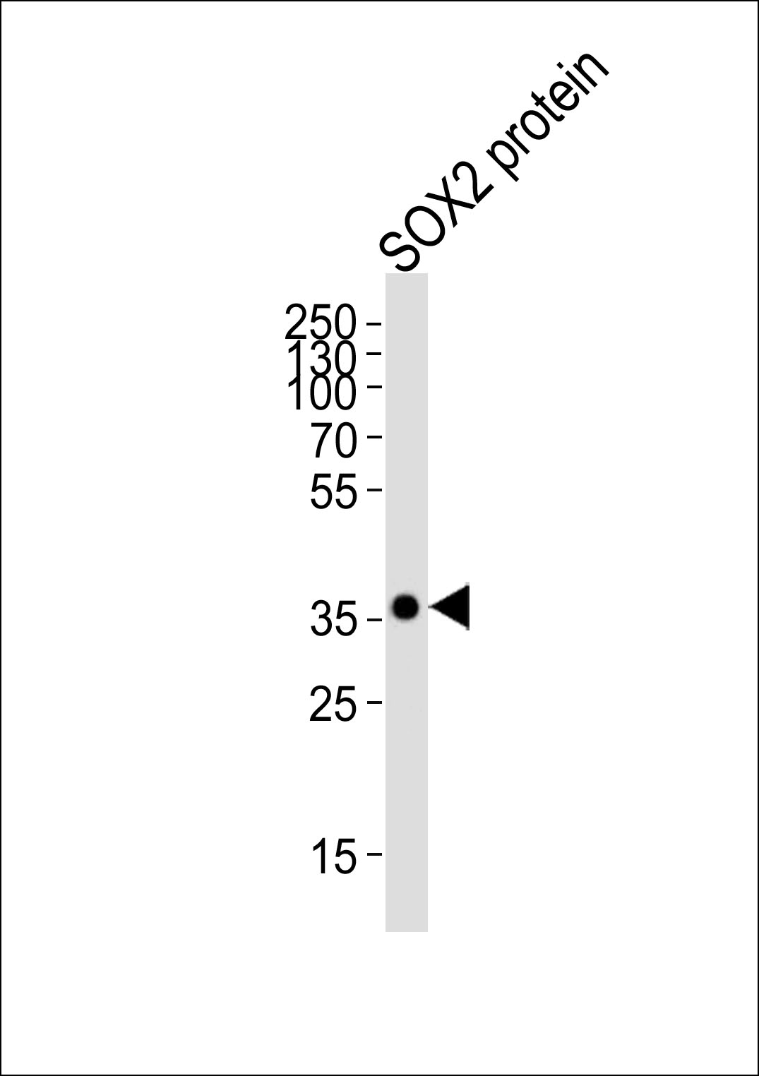 Mouse Monoclonal Antibody to SOX2