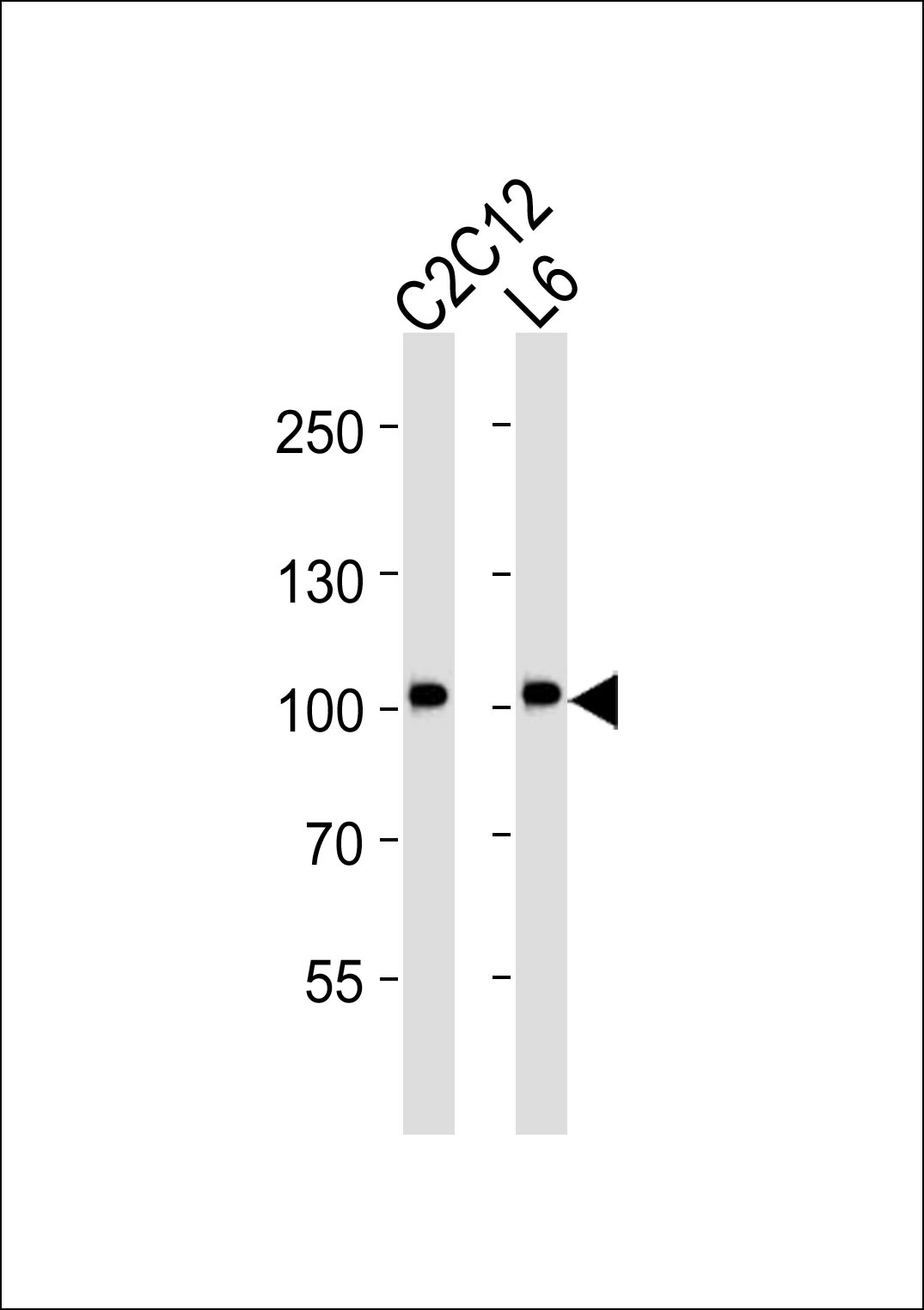 Mouse Monoclonal Antibody to Musk