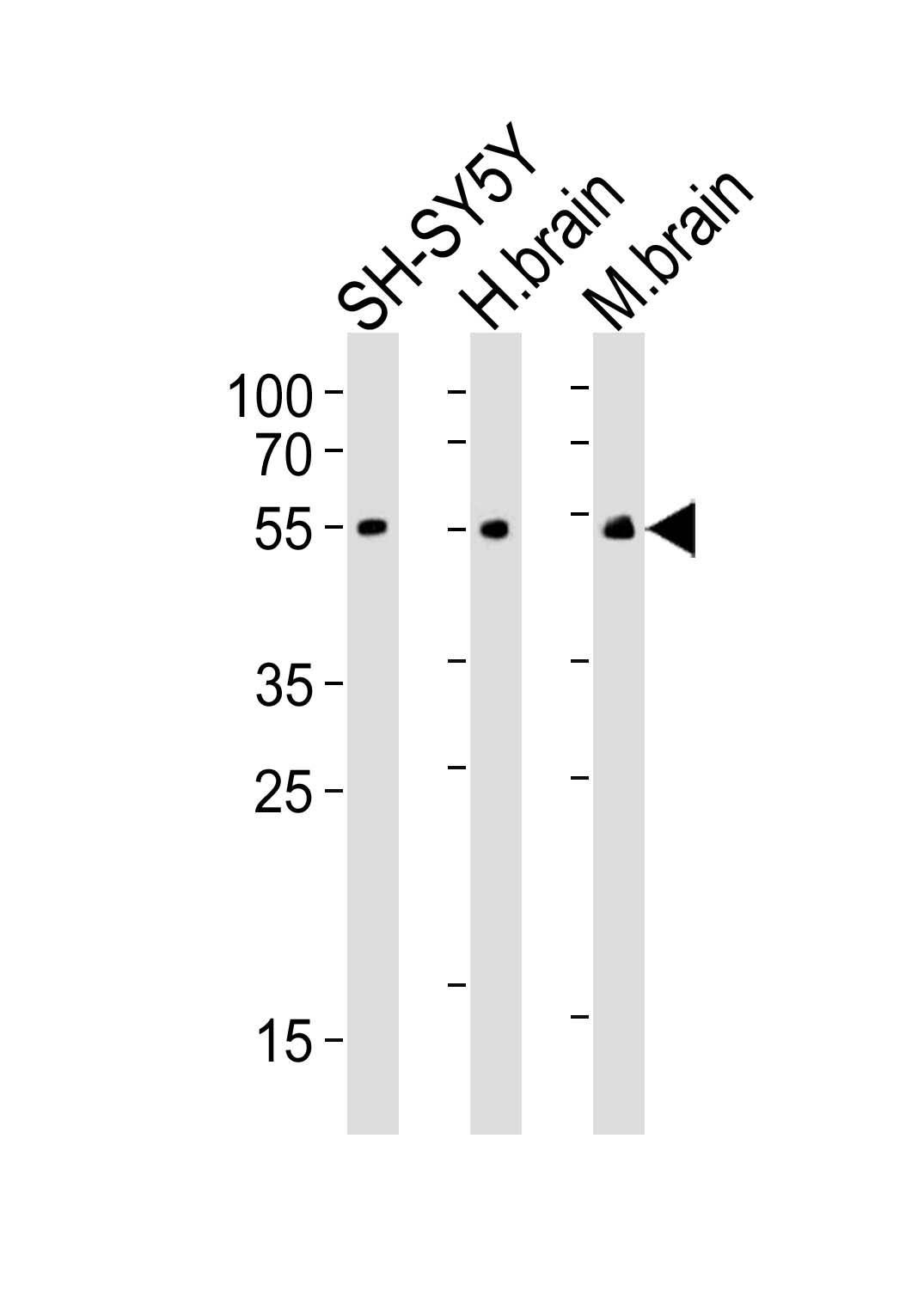 Mouse Monoclonal Antibody to CHRM2