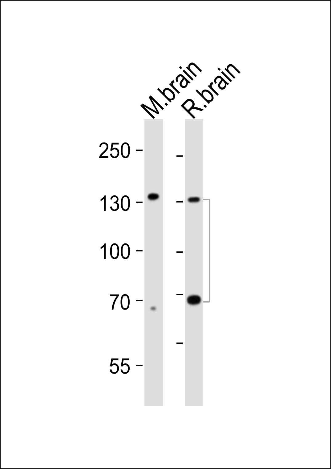 Mouse Monoclonal Antibody to Ntrk3