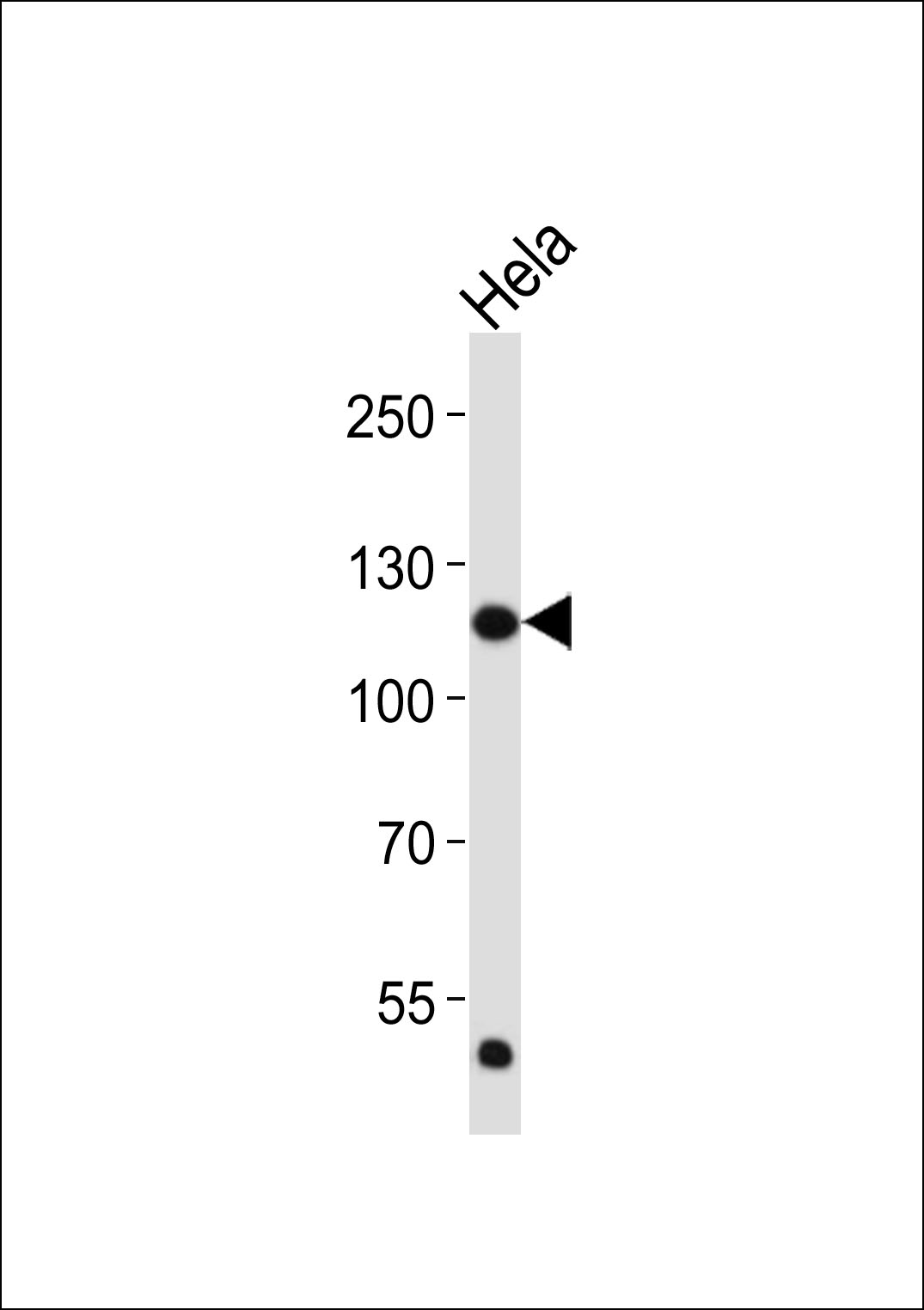 Mouse Monoclonal Antibody to FGFR1