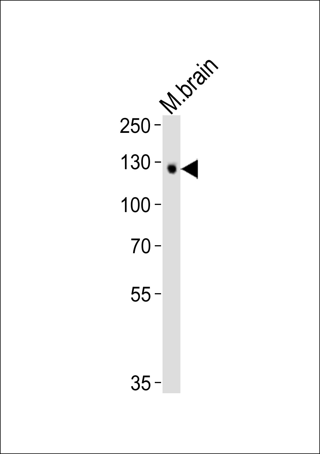 Mouse Monoclonal Antibody to Tyro3