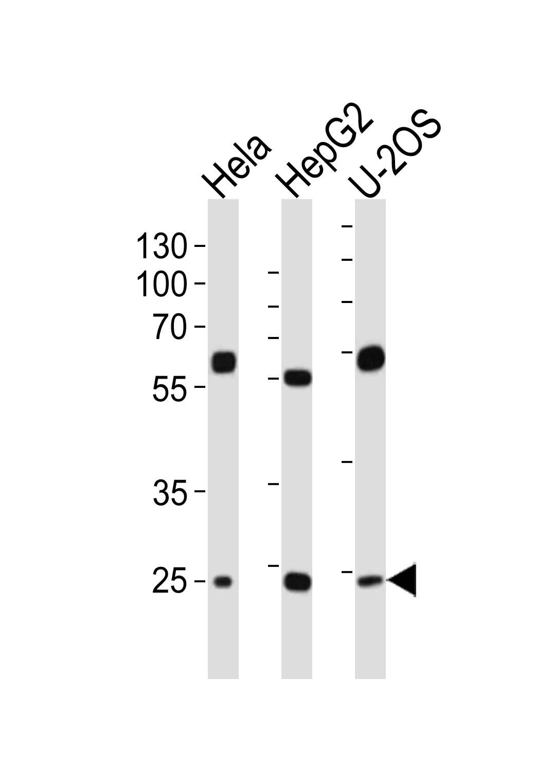 Rabbit Polyclonal Antibody to TFAM