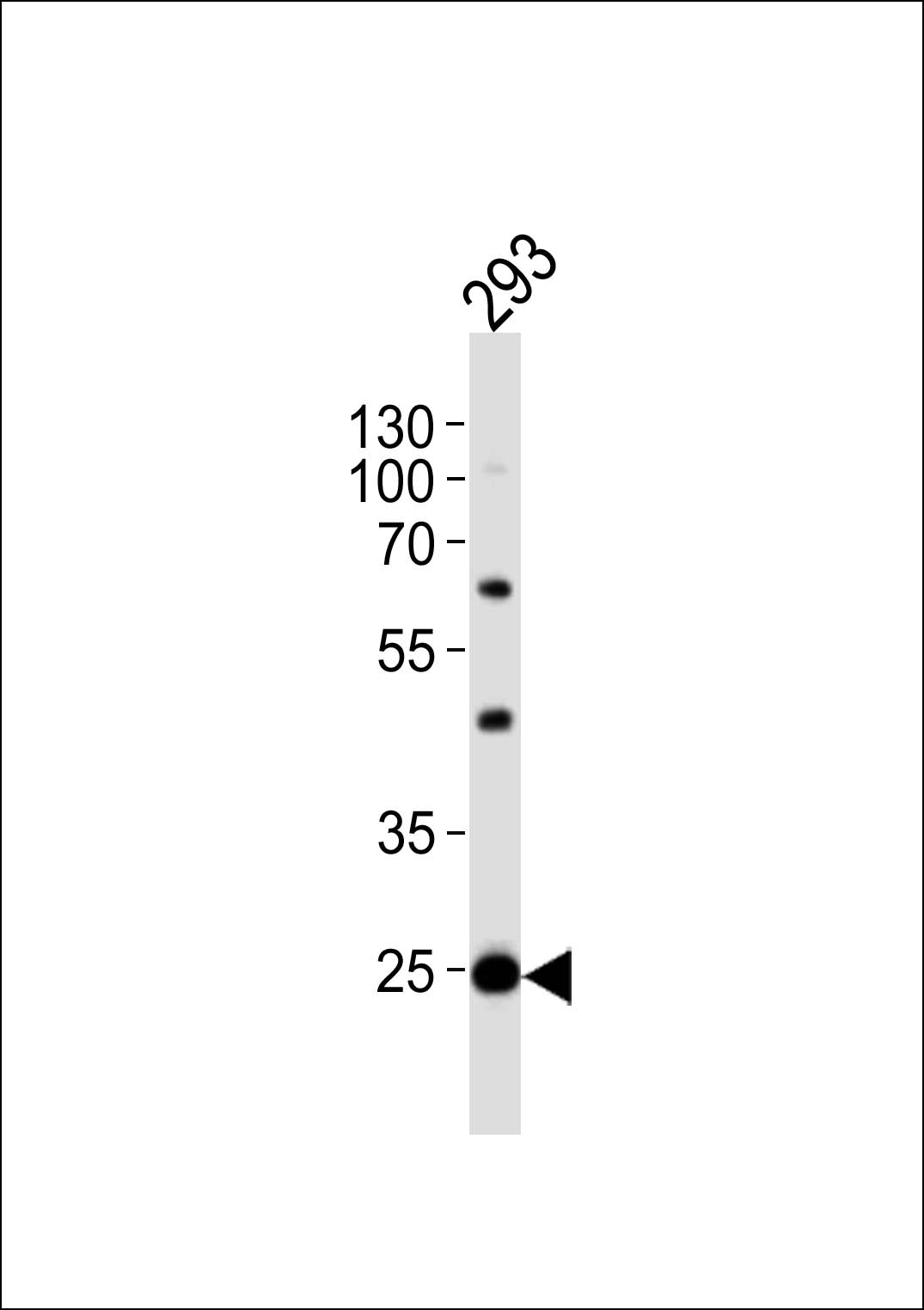 Rabbit Polyclonal Antibody to BCAS2 (N-term)