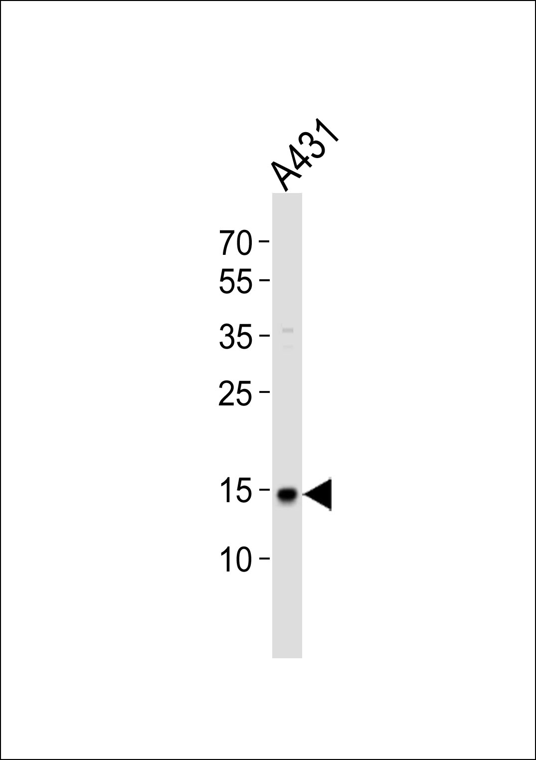 Rabbit Polyclonal Antibody to POLR2H (N-term)