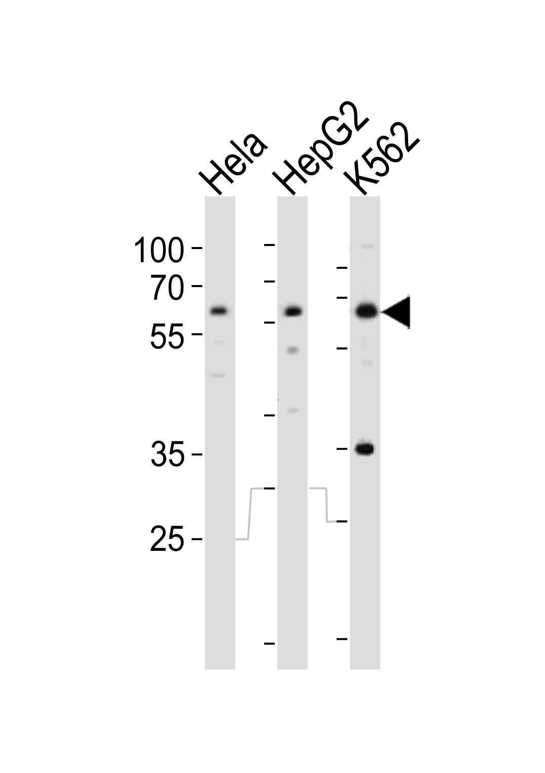 Rabbit Polyclonal Antibody to RIOK3
