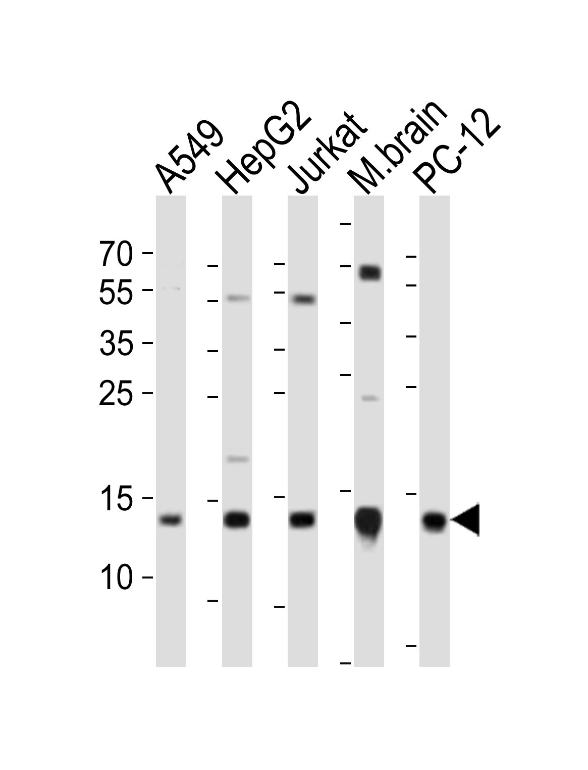 Rabbit Polyclonal Antibody to ATP5D