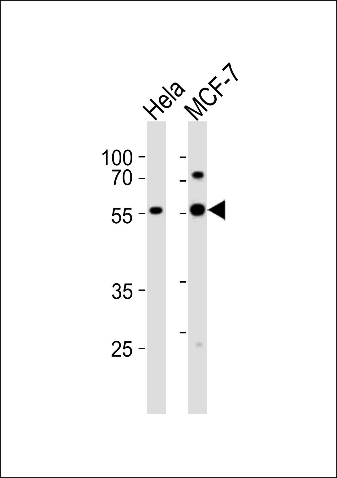 Rabbit Polyclonal Antibody to GATA6
