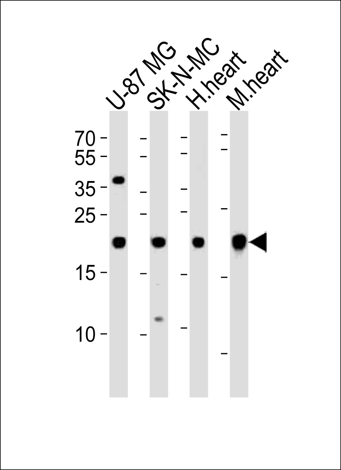 Rabbit Polyclonal Antibody to HES5
