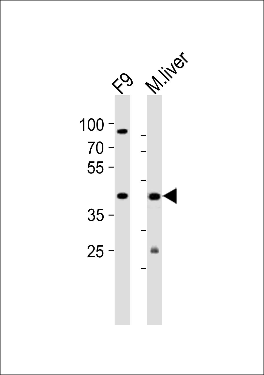 Rabbit Polyclonal Antibody to (Mouse) Ubtfl1