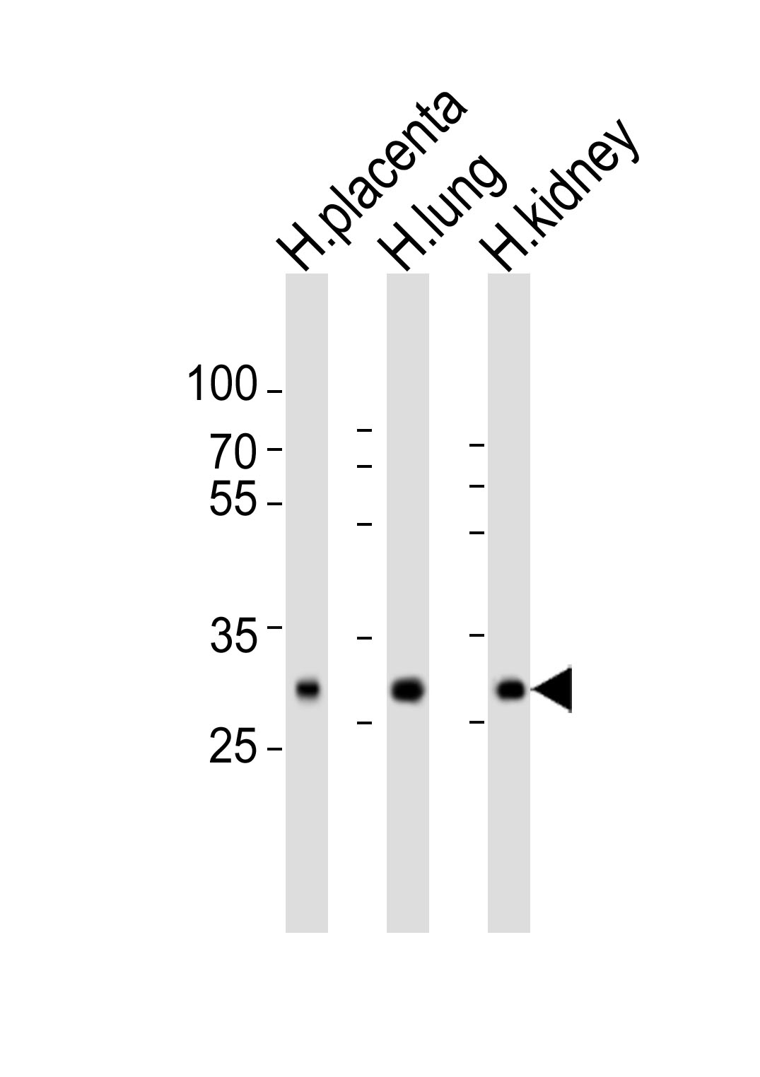 Rabbit Polyclonal Antibody to SOD3