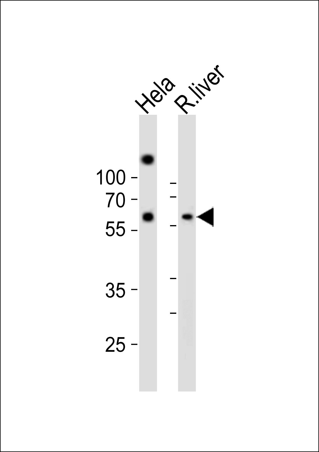 Rabbit Polyclonal Antibody to NFIA