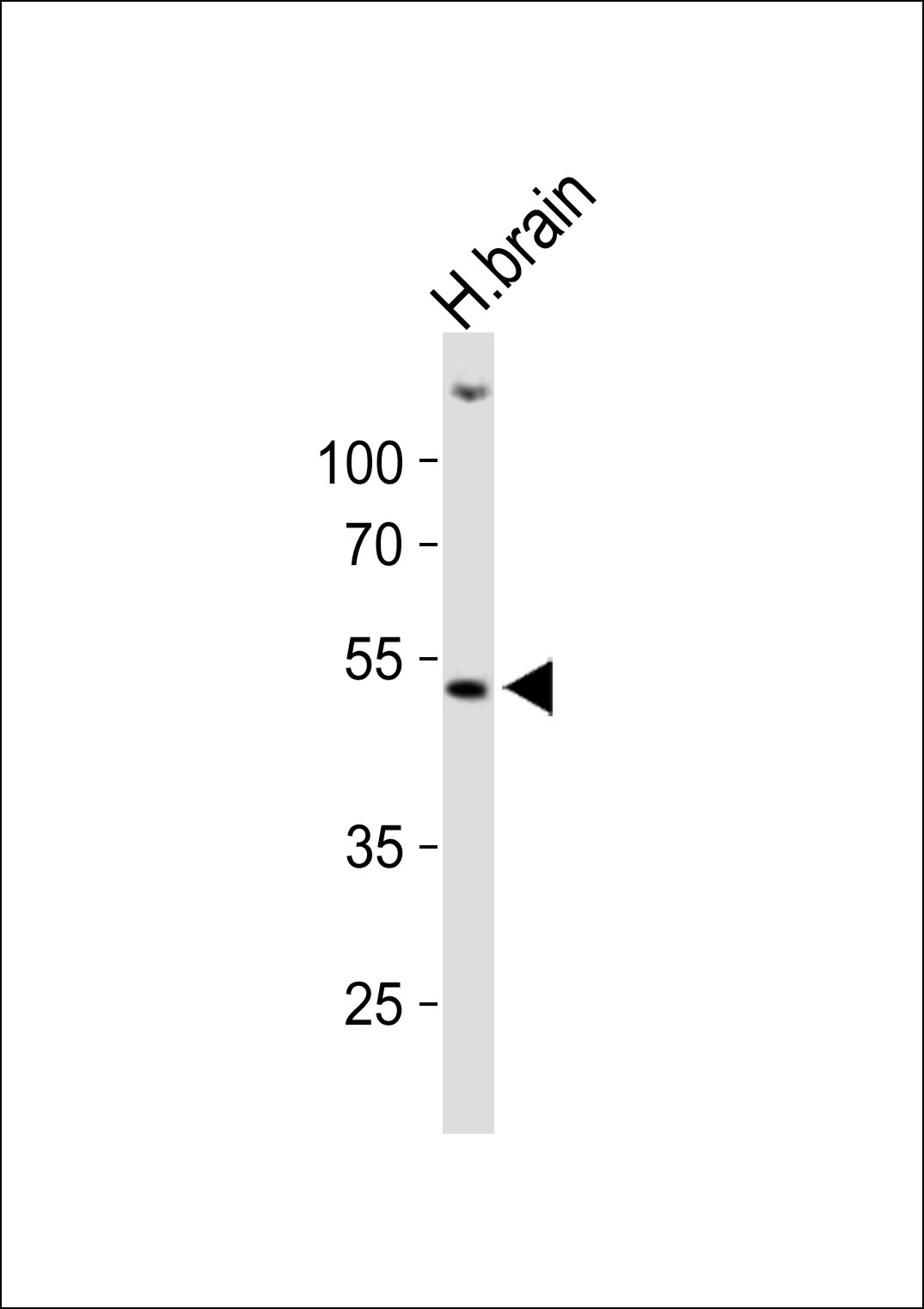 Rabbit Polyclonal Antibody to HCRTR1