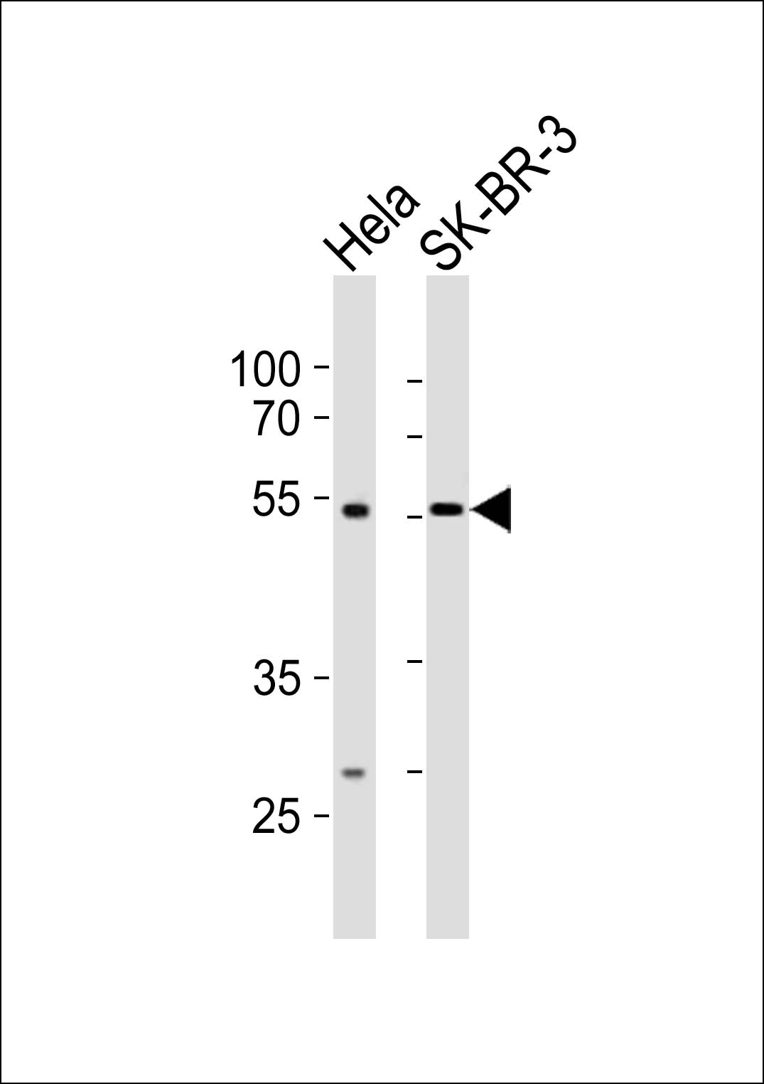 Rabbit Polyclonal Antibody to SMARCE1