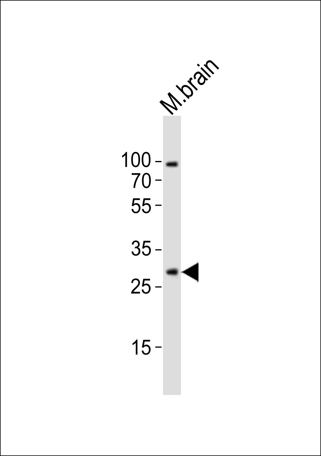 Rabbit Polyclonal Antibody to Mouse Olig1