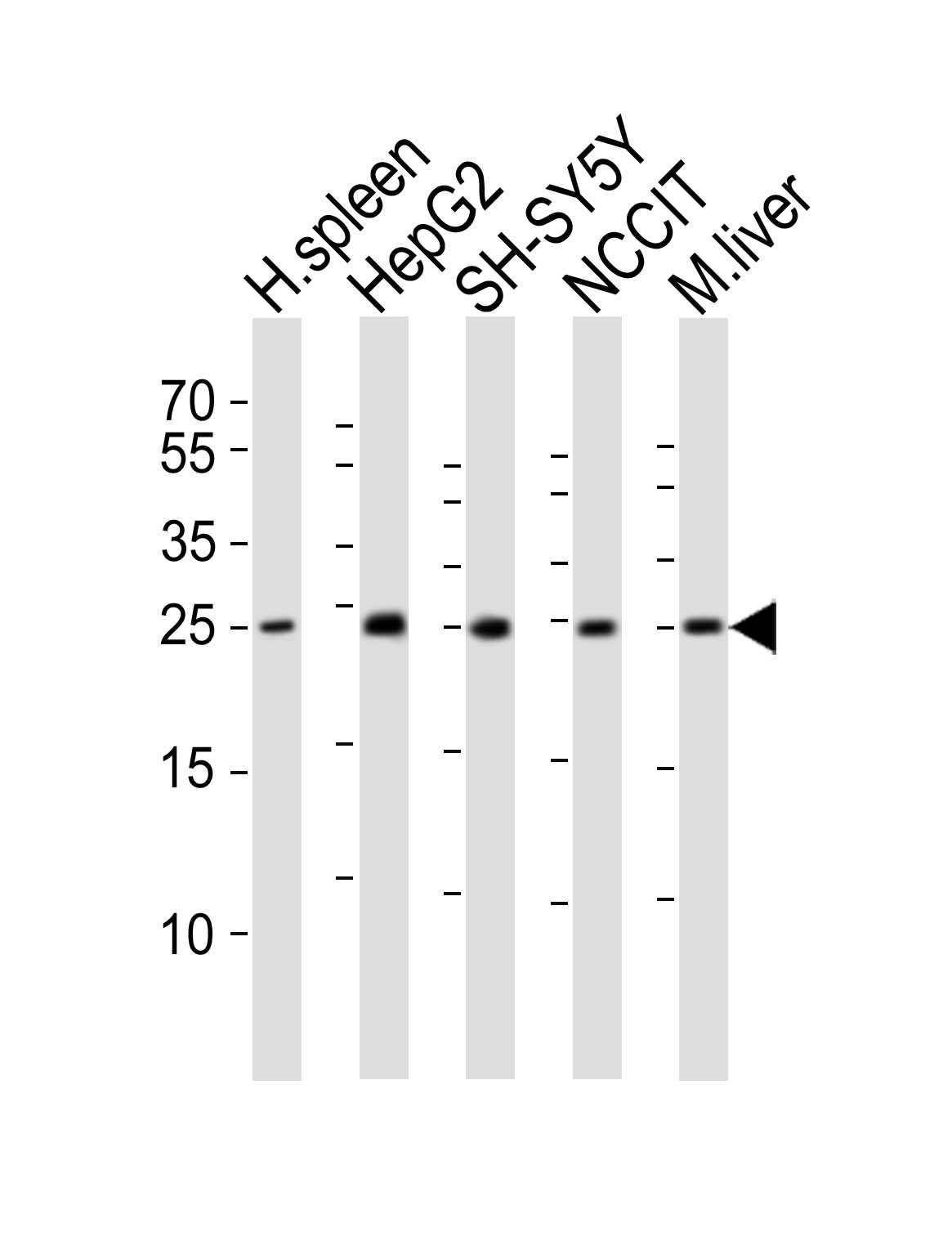 Rabbit Polyclonal Antibody to MIXL1