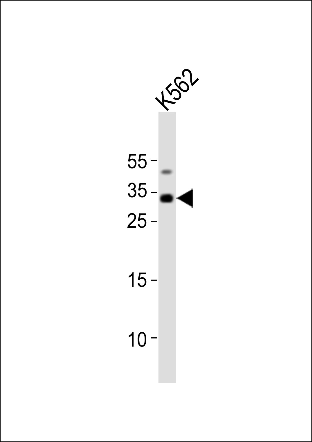 Rabbit Polyclonal Antibody to TAL1